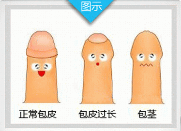 湖南割包皮医院