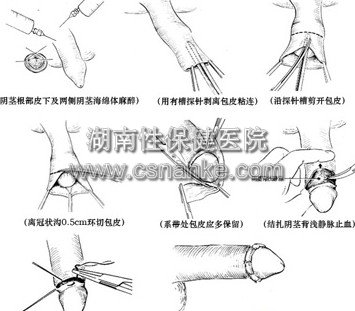 铜仁华南男科医院