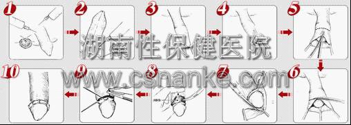 铜仁华南男科医院