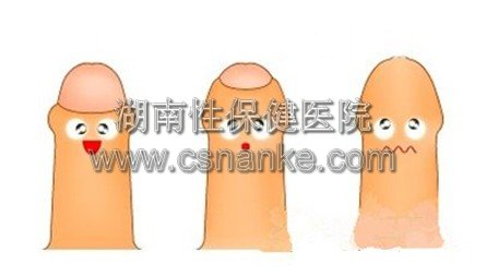 湖南性保健治疗包皮过长