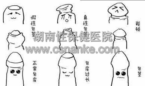 湖南性保健治疗包皮过长