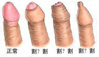 铜仁割包皮医院