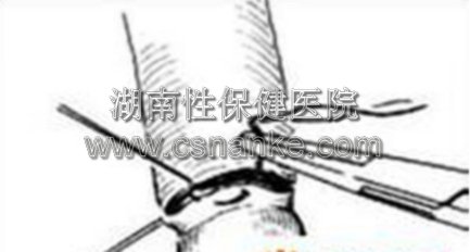 湖南性保健