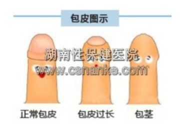 铜仁华南男科医院