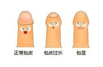 铜仁去哪家医院割包皮好