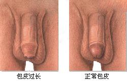 铜仁哪家医院可以割包皮