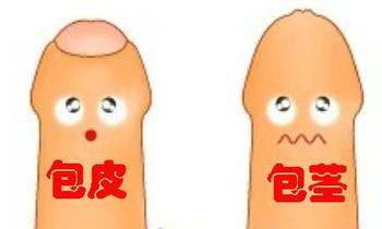 怎样才算是包皮过长呢