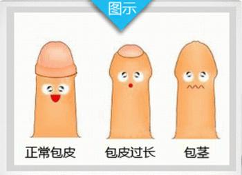 做包皮手术总共要花多少钱