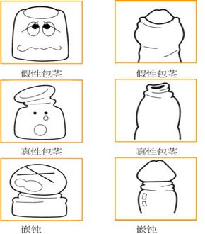 铜仁包皮手术大概价格是多少
