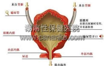 铜仁膀胱炎治疗