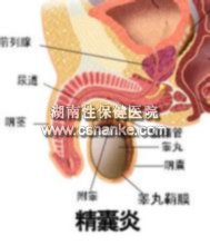 铜仁华南医院男科治疗精囊炎