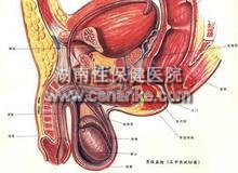 湖南治疗精囊炎