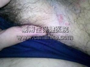 铜仁华南医院男科