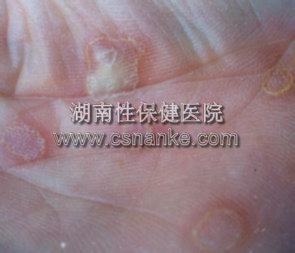 铜仁华南医院男科医院