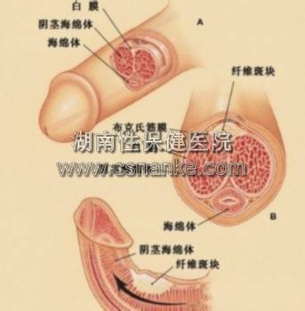 湖南性保健治愈性病