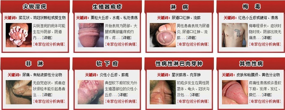 男性性疾病症状
